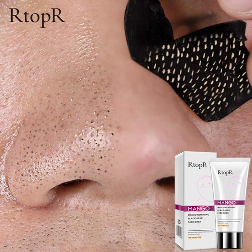 Mango Blackhead Remover Acne Treatment Oil control Mud Pore Strip Mask Cream Peel off Nose Skin oz - jnpworldwide