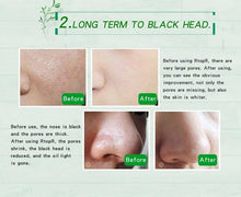 Load image into Gallery viewer, Mango Blackhead Remover Acne Treatment Oil control Mud Pore Strip Mask Cream Peel off Nose Skin oz - jnpworldwide