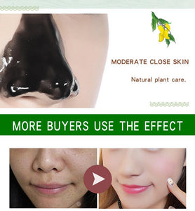 Mango Blackhead Remover Acne Treatment Oil control Mud Pore Strip Mask Cream Peel off Nose Skin oz - jnpworldwide