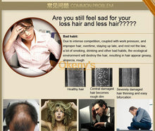 Load image into Gallery viewer, Genuine Professional Hair ginger Shampoo 300ml Dense Fast Thicker Shampoo Anti Loss growth oz - jnpworldwide