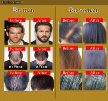 Load image into Gallery viewer, Organic Fast Hair Growth Essence Liquid Products Anti Gray Hair Spray Shampoo Serum Loss Treatment - jnpworldwide
