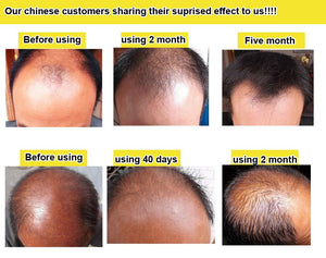 Organic Fast Hair Growth Essence Liquid Products Anti Gray Hair Spray Shampoo Serum Loss Treatment - jnpworldwide