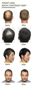 Hair extensions Fiber Loss Patch head Treatment Anti Bald Beauty salon Makeup natural man woman - jnpworldwide
