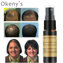Load image into Gallery viewer, Organic Fast Hair Growth Essence Liquid Products Anti Gray Hair Spray Shampoo Serum Loss Treatment - jnpworldwide