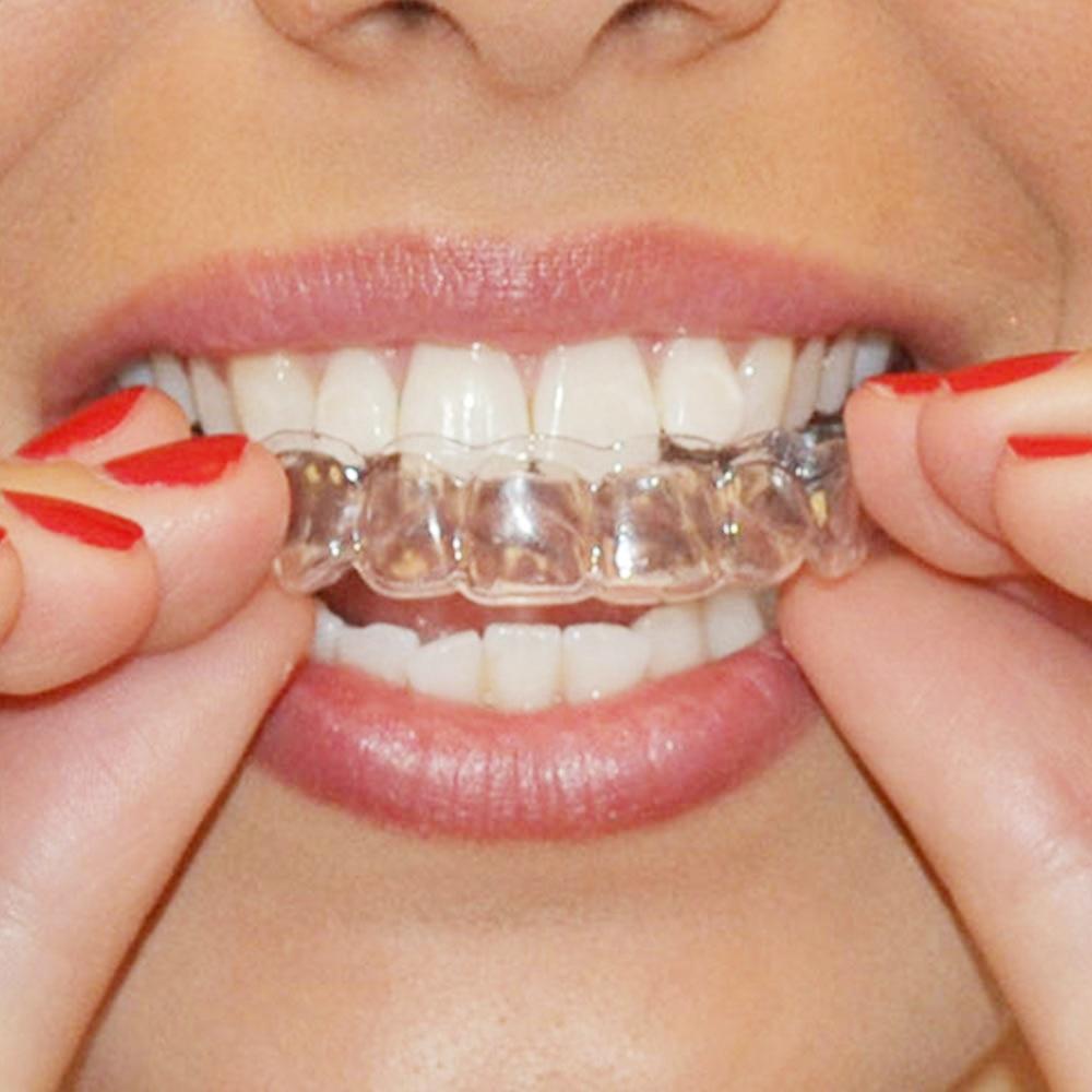 Dental Mouthguard Teeth Whitening Trays Bleaching Tooth Whitener Mouth Guard Care Oral Hygiene kit - jnpworldwide