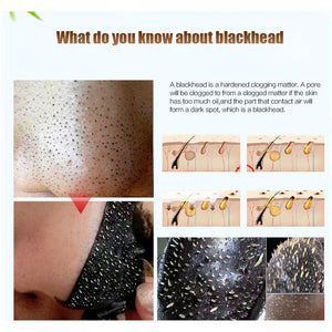 Black Mask Blackhead Remover Nose Mask Pore Strip Acne Treatment Face Peel Off Skin Care Strips - jnpworldwide